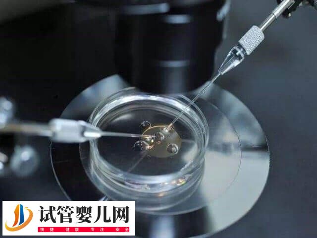 先天性肾积水能不能做试管