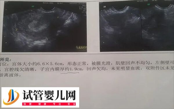 打了降调内膜会不会薄(图1)