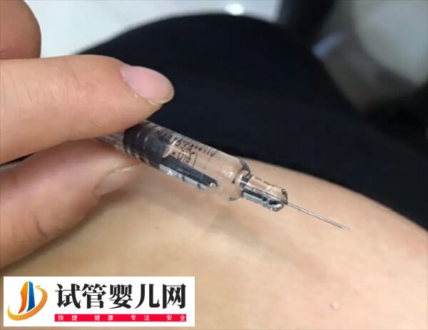 试管婴儿长方案和短方案哪个好