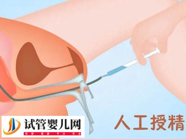 桂平人工授精价格多少