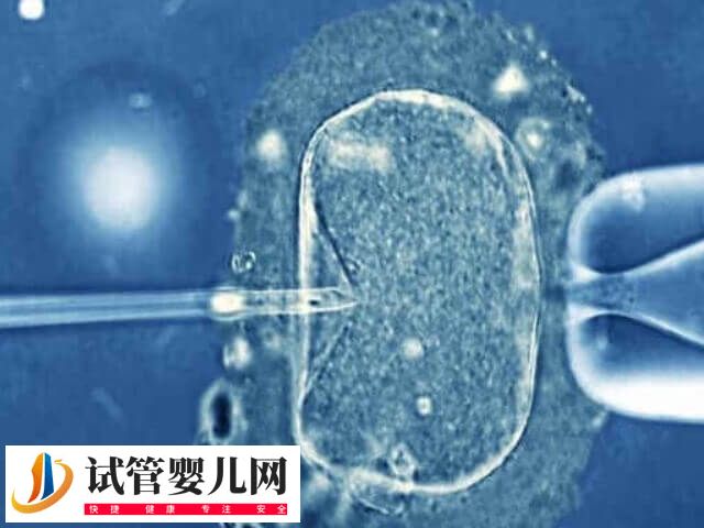 三代试管费用高不高