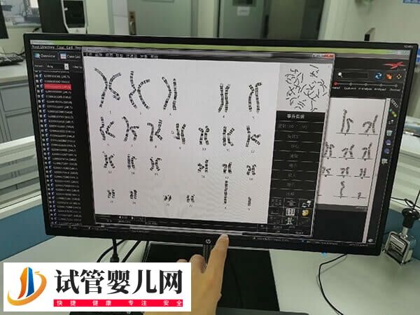 怀唐氏儿的原因有哪些