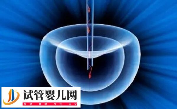 一代试管会把畸形精子删除挑出A级精子吗？