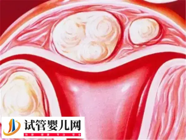 子宫内膜薄能不能做试管婴儿