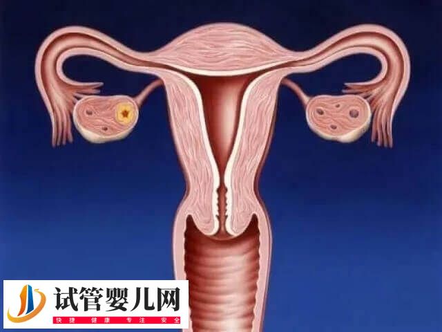 子宫内膜薄能不能做试管婴儿(图2)